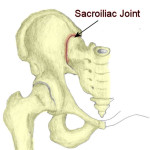 SI-joint